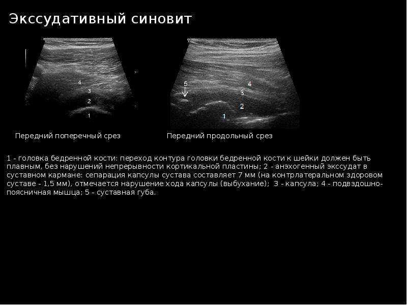 Узи протоколы суставы