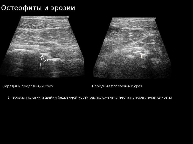 Узи суставов презентация