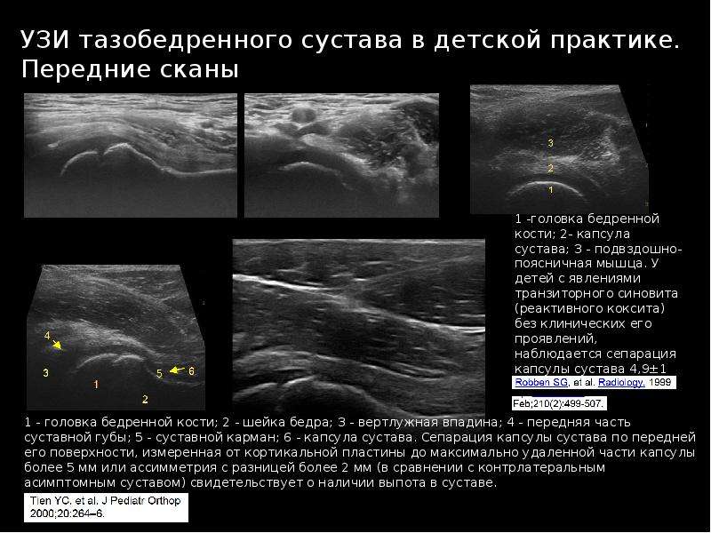 Узи суставов презентация