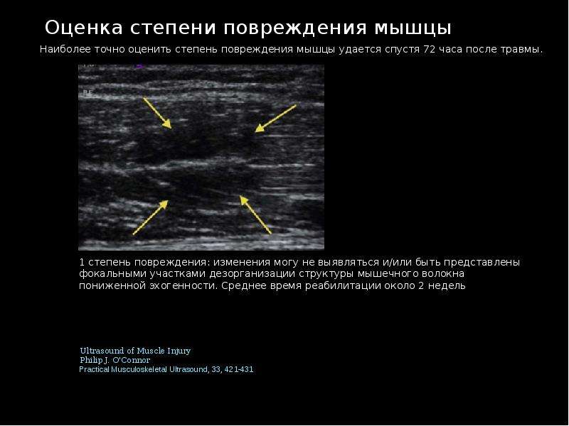 Образец протокола узи коленного сустава