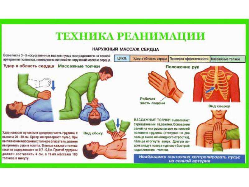 Картинки по сердечно легочной реанимации