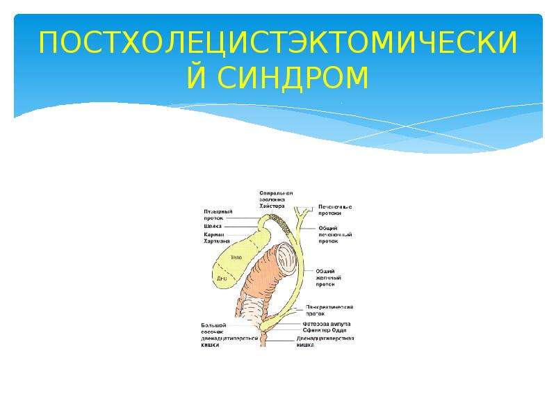 Постхолецистэктомический синдром презентация