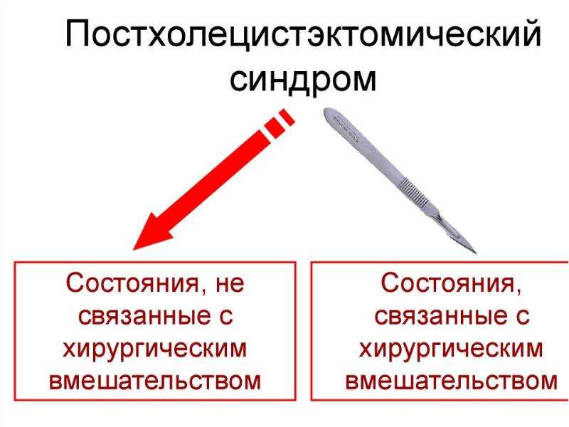 Постхолецистэктомический синдром презентация