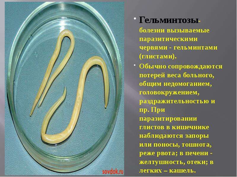 Гельминтозы- болезни вызываемые паразитическими червями - гельминтами (глистами). Обычно сопровождаю