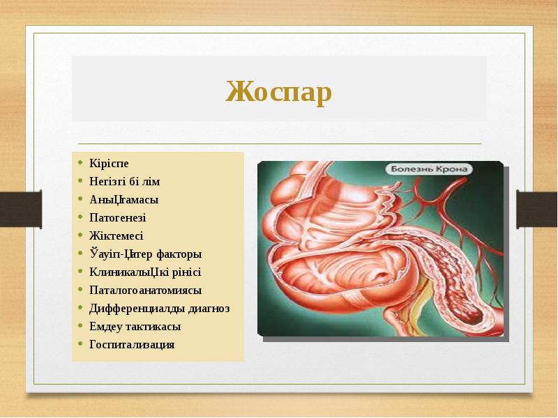 Крон ауруы презентация