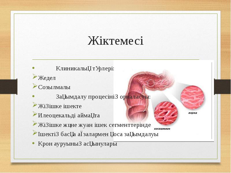 Крон ауруы презентация