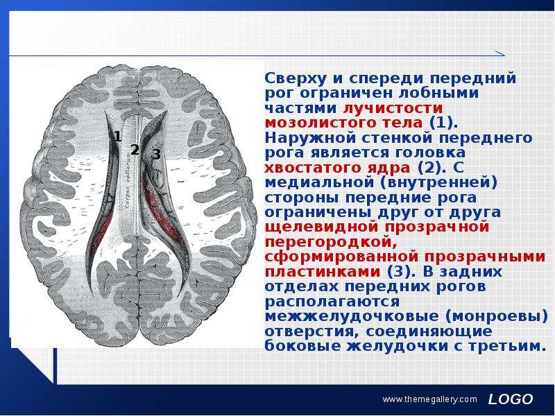 Рассечение мозолистого тела