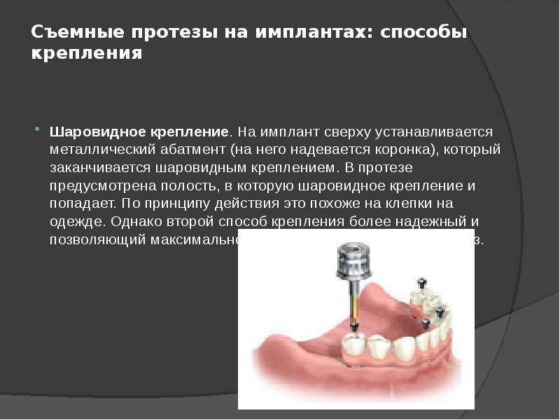 Анатомические предпосылки стоматологической имплантации презентация