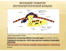 Механизм развития атеросклеротической бляшки