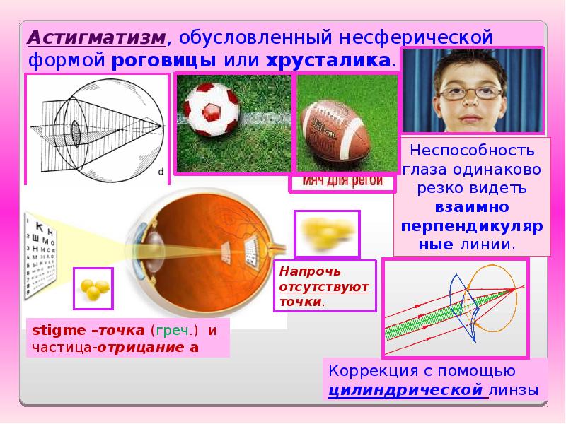 Гиперметропический астигматизм обоих глаз. Астигматизм физика. Астигматизм линзы физика. Обратный астигматизм. Цилиндрическая линза астигматизм.