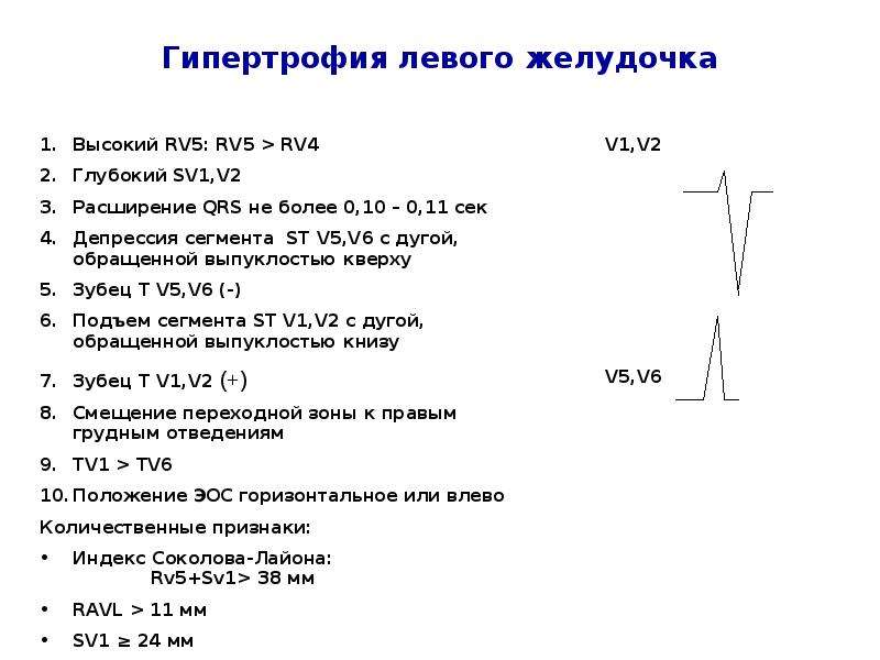 Сколько действительно экг