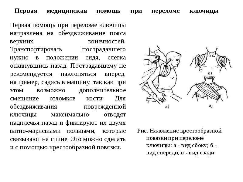 Перелом ключицы карта вызова