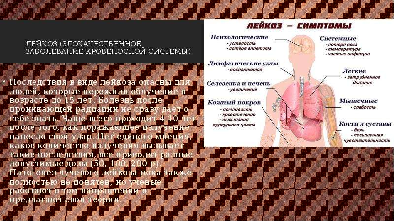 Радиационное загрязнение проект