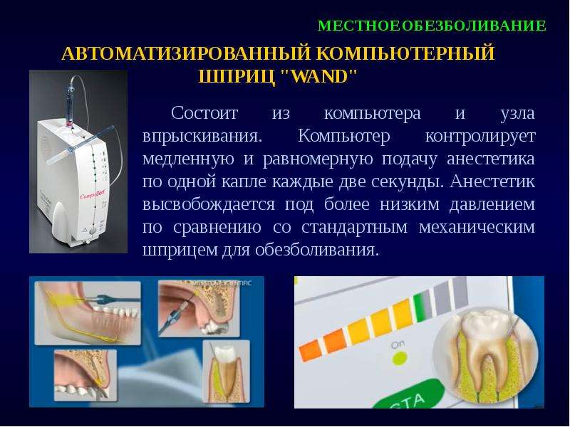 Презентация на тему обезболивание