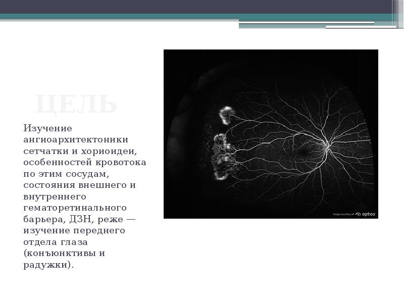 Ангиография глаза. Ангиография цель исследования. Флюоресцентная ангиография Радужки. Методы исследования хориоидеи. Гематоретинальный барьер сетчатки.