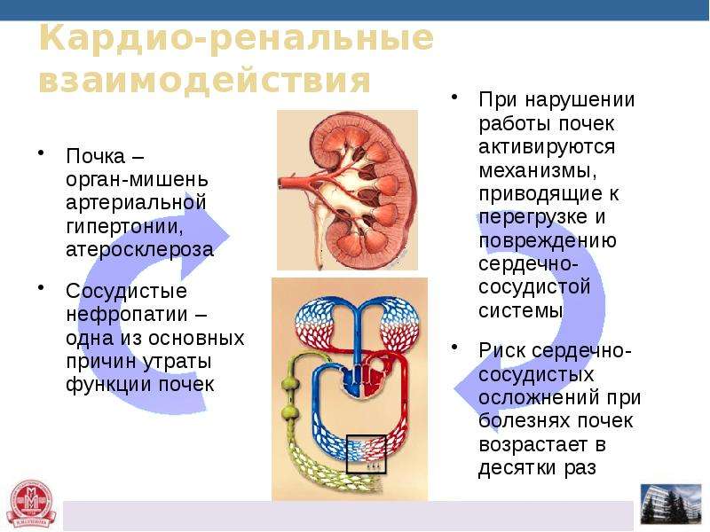 Хроническая болезнь почек картинки