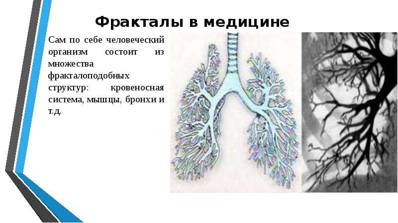 Фракталы в медицине картинки