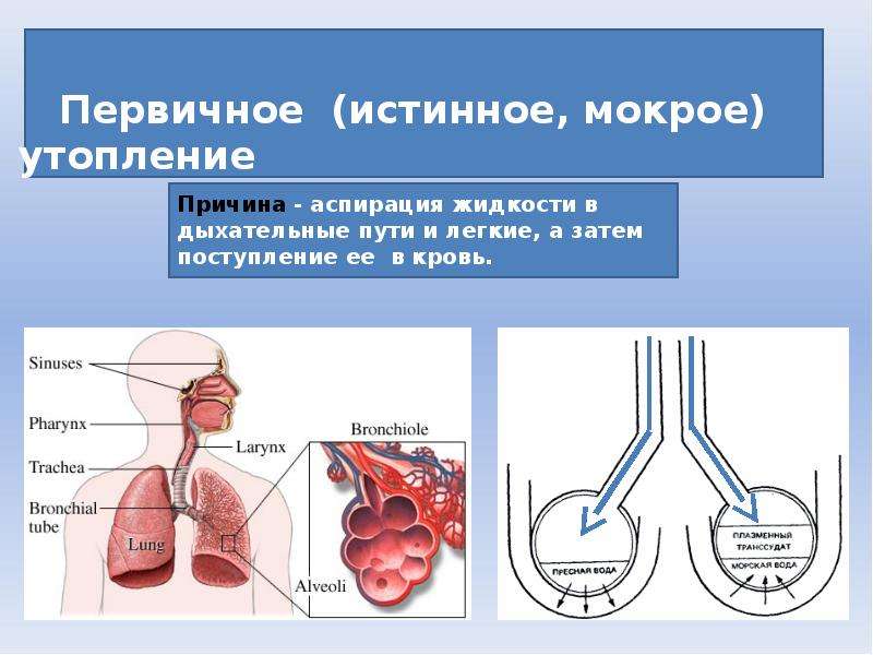 Утопление презентация медицина