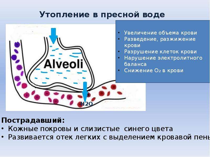 В пресной воде кусок картофеля тонет. Утопление в пресной воде. Утопление в пресной воде клиническая картина.