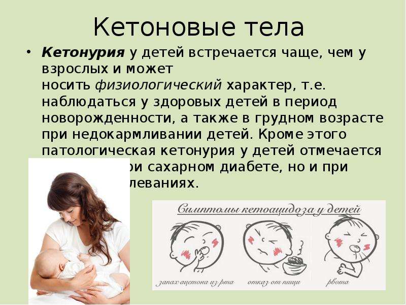 Кетонурия что это. Кетонурия у детей. В грудном возрасте часто встречаются. В грудном возрасте наиболее часто встречаются. Патологический компонент мочи.