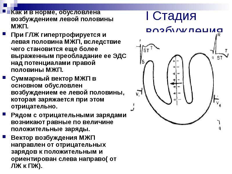 Межжелудочковая перегородка экг