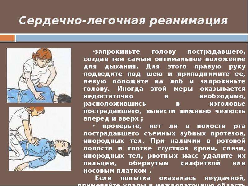 Реанимация взрослого пострадавшего. ПМП сердечно легочная реанимация. Сердеснолегочная реанимация. Сердечнолегочная реанимаци. Снидечно легочная реанимаци.