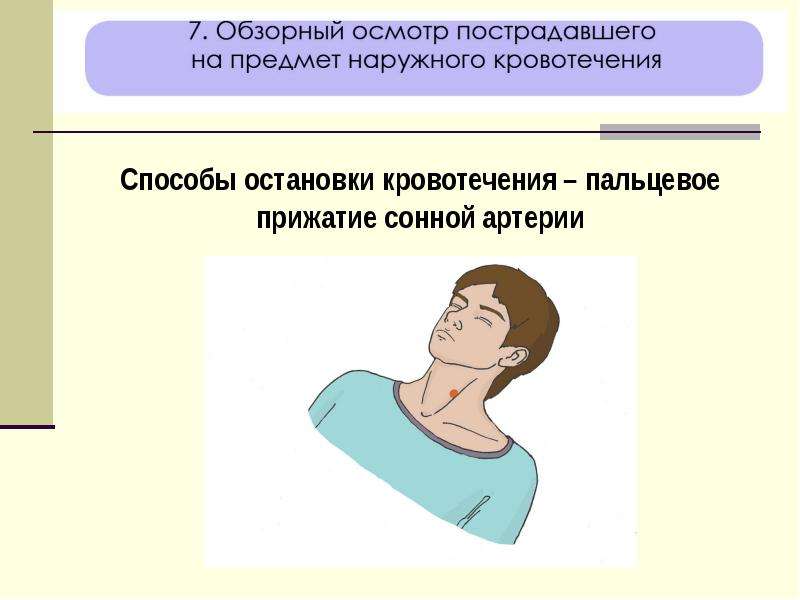 Остановить кровотечение на сонной артерии ответ тест. Оказание первой помощи при прочих состояниях. Прижатие сонной артерии. Прижатие сонной артерии при кровотечении. Места прижатия артерий.