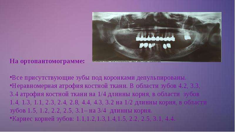 Клинический случай по ортопедической стоматологии презентация