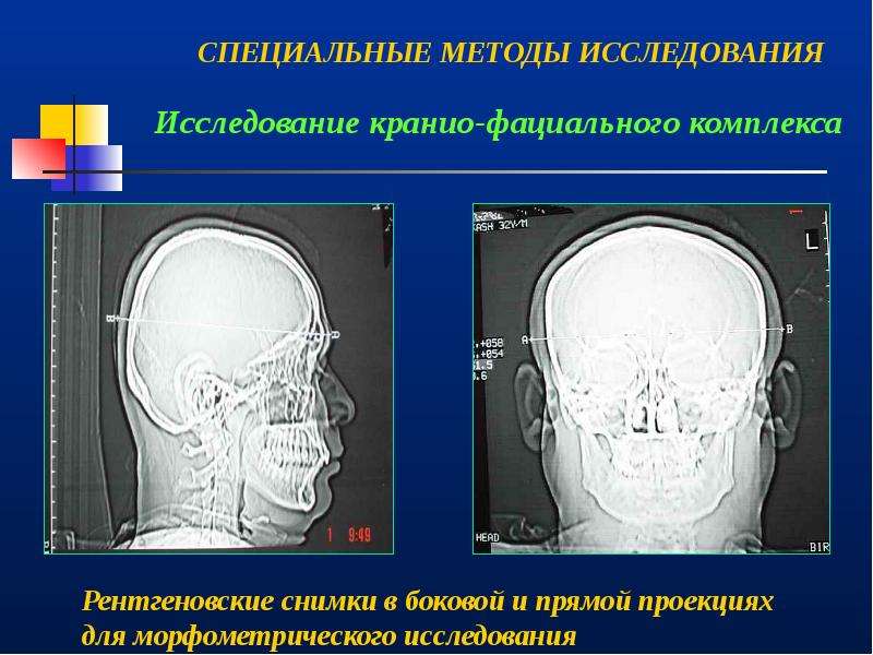 Клиническое обследование ортодонтического пациента презентация