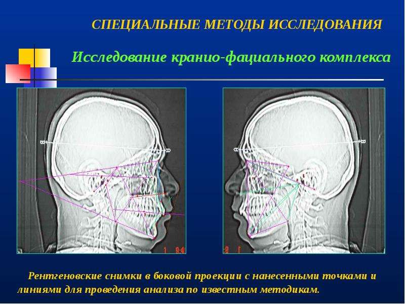 Клиническое обследование ортодонтического пациента презентация