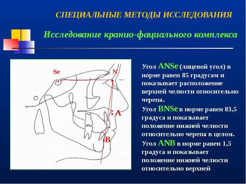 Клиническое обследование ортодонтического пациента презентация