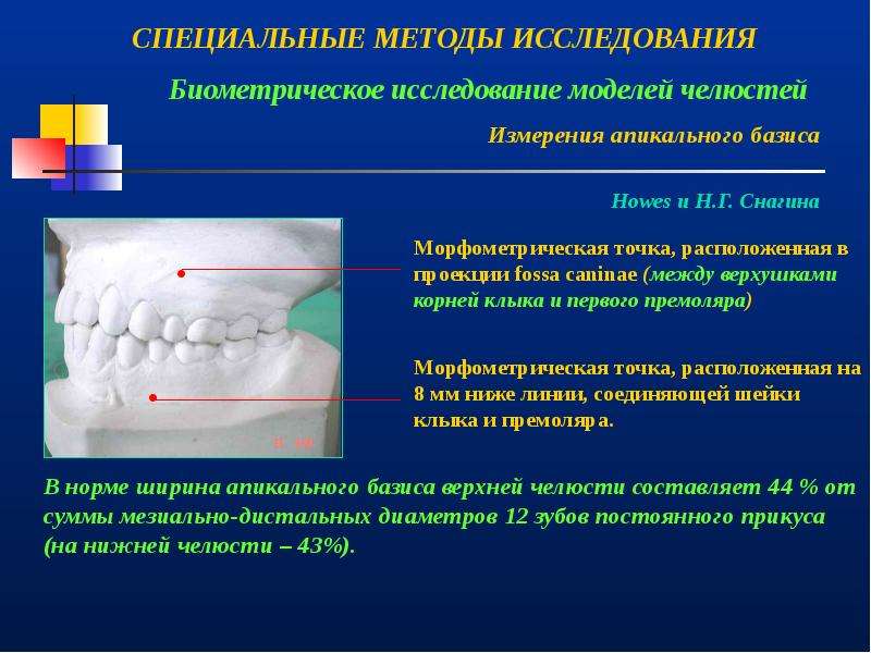 Рентгенологические методы исследования в ортодонтии презентация