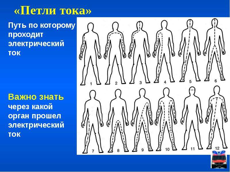 Ток прошел через человека