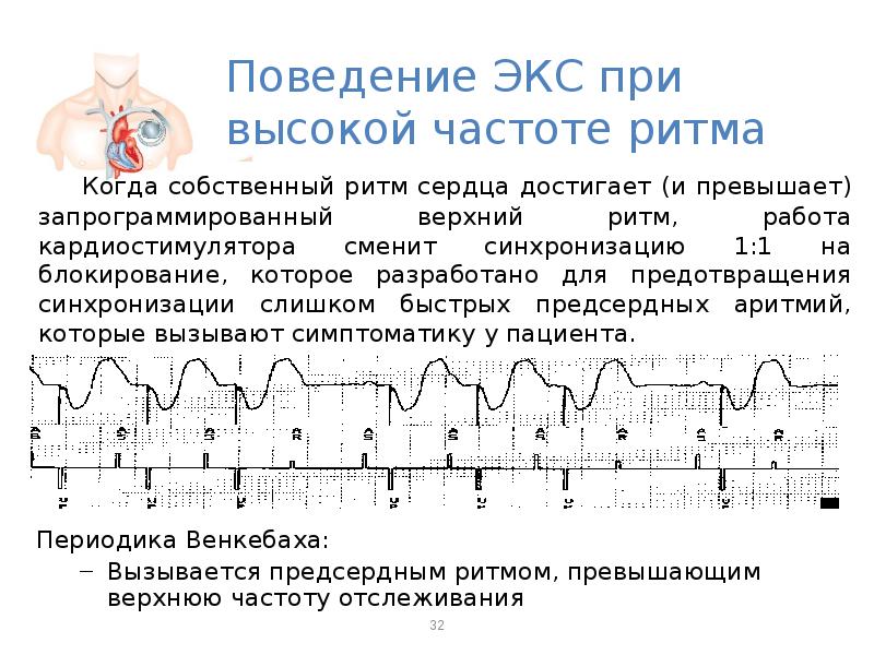 Физические основы электрокардиографии презентация