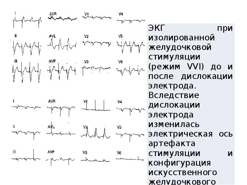 Схема курации больного