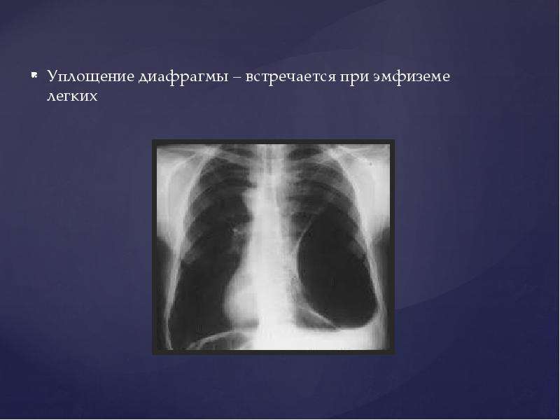 Презентация рентген легких
