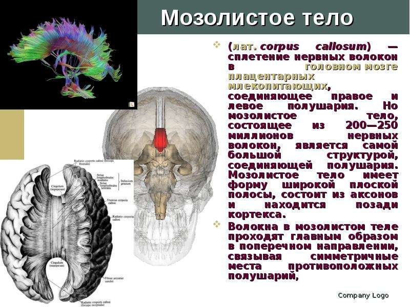 Рассечение мозолистого тела