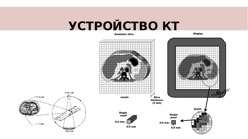 Схема получения изображения кт