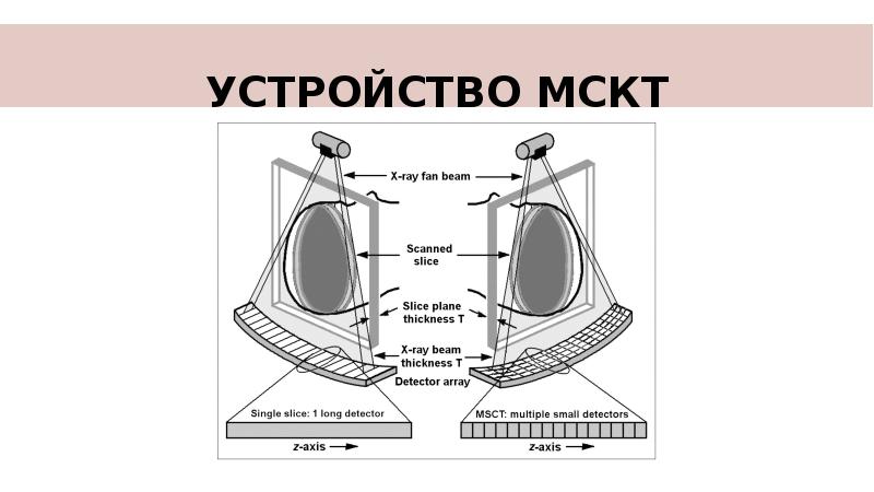 Схема компьютерная томография