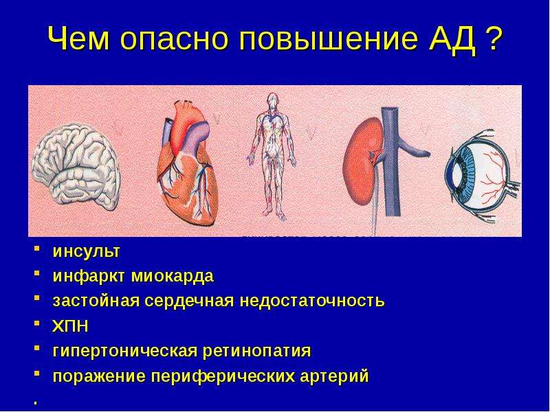 история артериальной гипертонии