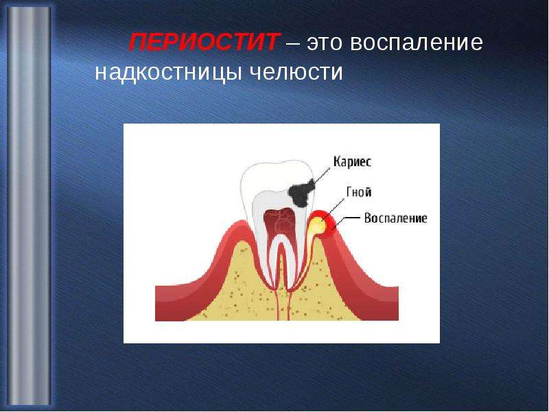 Надкостница зуба строение фото