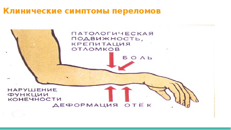 Переломы кисти травматология презентация