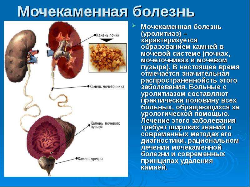 Патология почек презентация