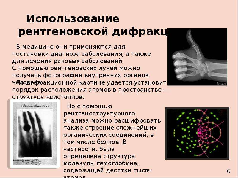 Рентгеноструктурный анализ фото