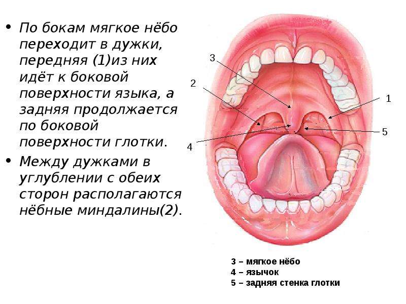 Небные дужки