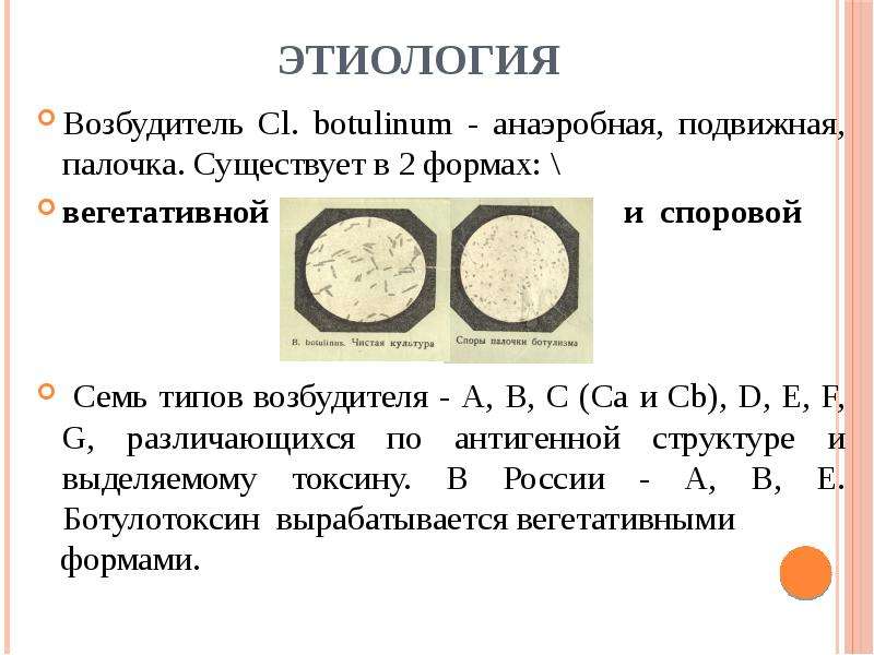 Ботулизм патогенез схема