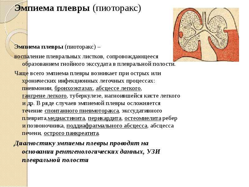 Гидроторакс легких карта вызова