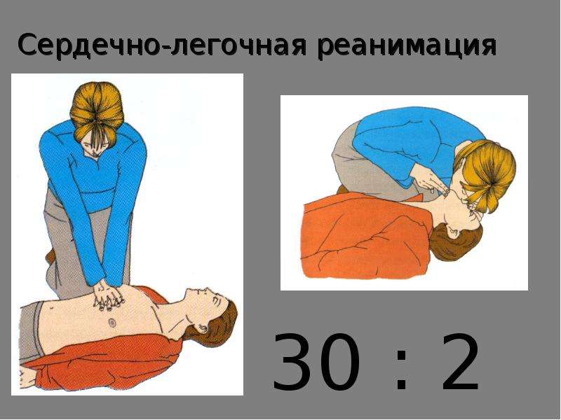 Картинки по сердечно легочной реанимации