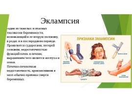 Эклампсия