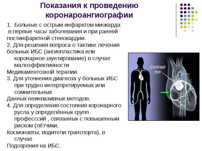 Составьте план обследования пациента с инфарктом миокарда противопоказания к коронароангиографии